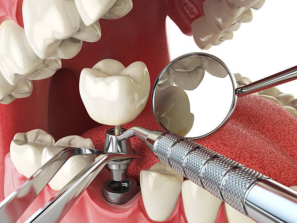  Rossmoor, CA Emergency Dentist Pros
